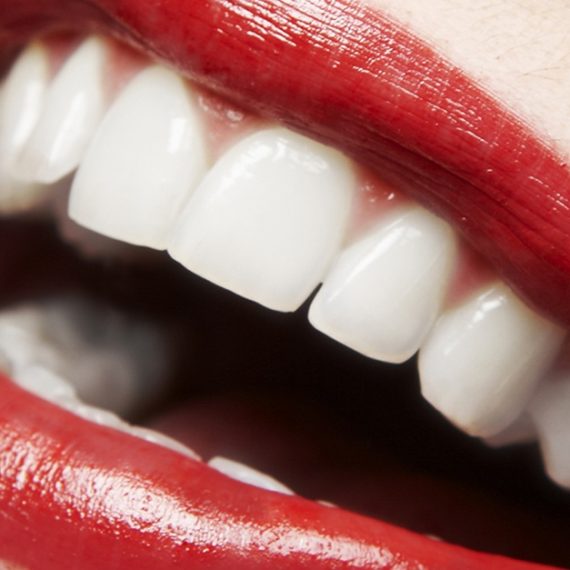Dental Check-Up With Optional Stain Removal